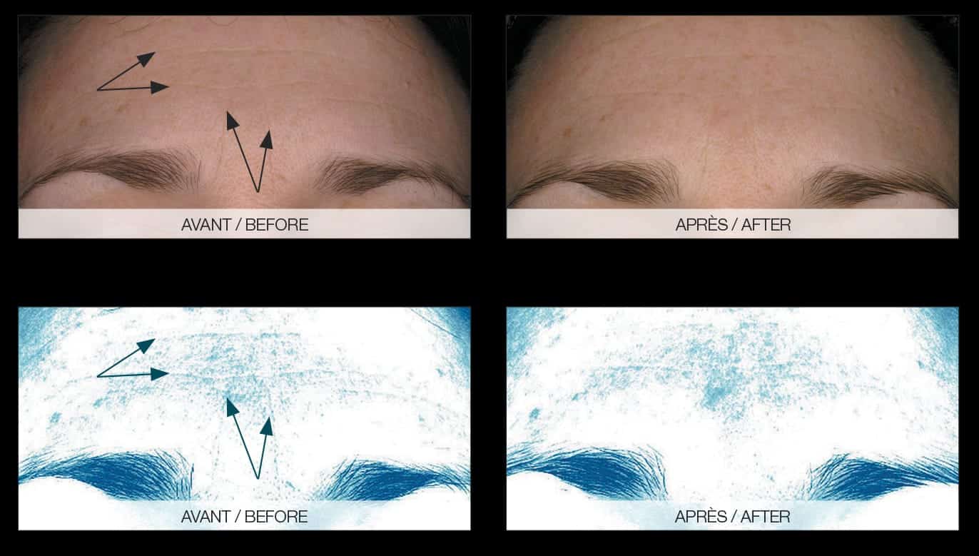 face-treatment-before-after